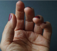 Stop nail-biting